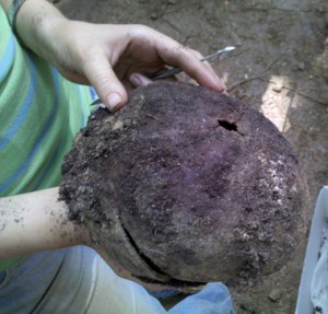 A hole in the back of this skull is being carefully examined. 